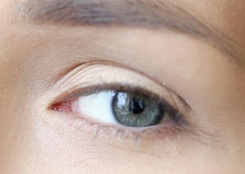 孝感美白導(dǎo)入醫(yī)生