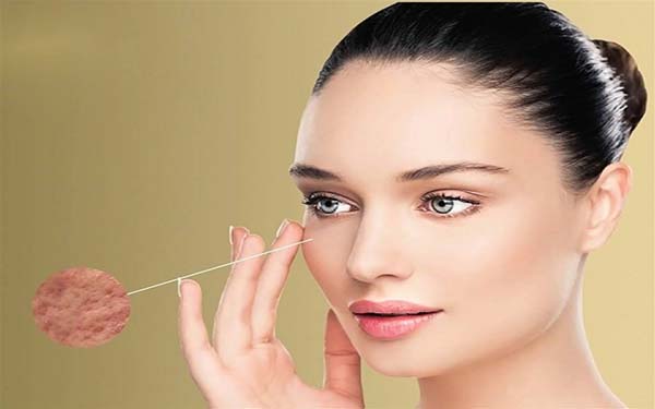 鄭州光電去動(dòng)態(tài)細(xì)紋醫(yī)生