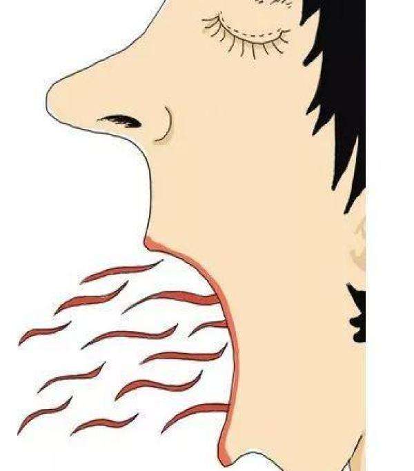 海南微整頸部皺紋醫(yī)生