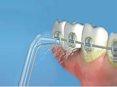 大連針雕祛除口周紋醫(yī)生