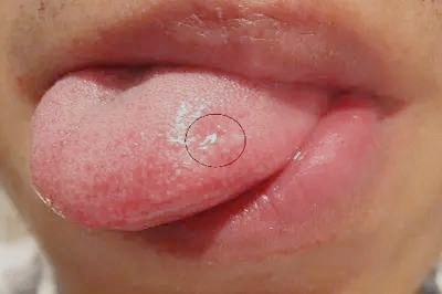 濮陽激光去細(xì)紋醫(yī)生