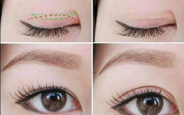 2023年臨沂市治療色斑好的醫(yī)療機構(gòu)比較，一個新的醫(yī)院排名榜發(fā)布！公立、私立醫(yī)院對比分析結(jié)果-最新報價一