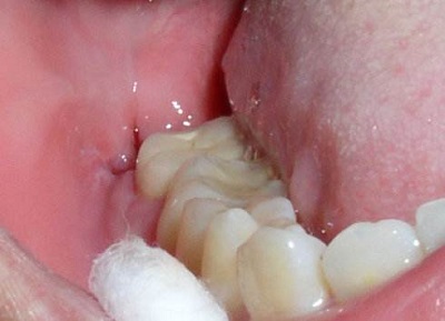 2023南寧地區(qū)五家頂尖牙科醫(yī)院排名揭曉，備受贊譽(yù)！