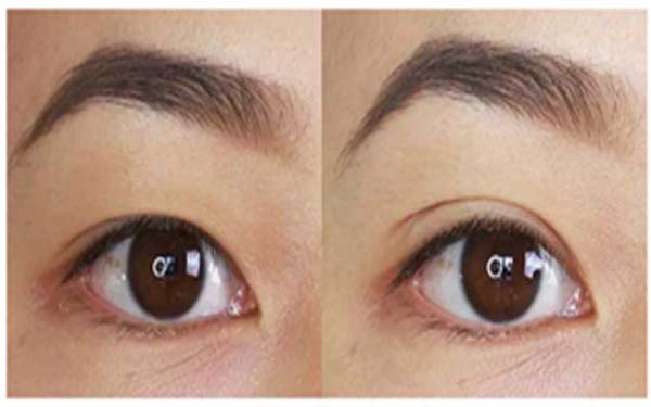 2023年亳州地區(qū)最受矚目的吸脂手術(shù)醫(yī)院盤點，前三強醫(yī)院非常值得關(guān)注！