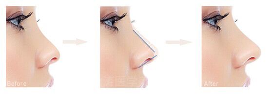 2023北京優(yōu)秀口腔醫(yī)院排行榜：協(xié)和、同仁再獲口碑認(rèn)可！實(shí)力可信賴！