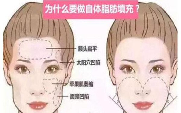 2023全國頜面整形醫(yī)生排名榜單發(fā)布！這些專家醫(yī)生值得關(guān)注