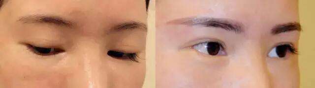 2023年上海好口碑的種植牙醫(yī)院推薦！看看這幾家醫(yī)院的技術如何！