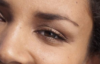 2023山西省脫疤權(quán)威醫(yī)院匯總 Top5，低價高效無憂祛疤！