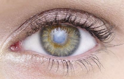 2023年廣州市頭發(fā)移植醫(yī)院排行榜：最好的醫(yī)院居首，引領(lǐng)新潮流！