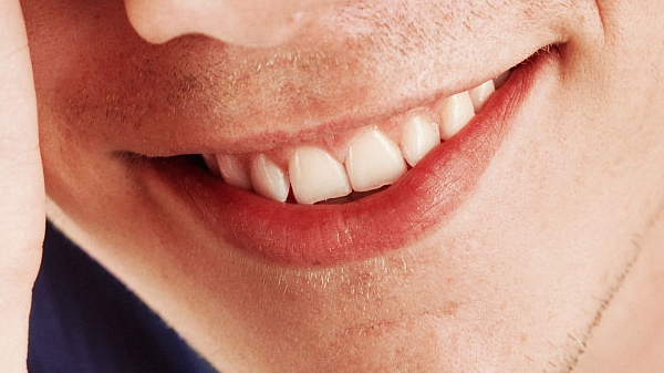 長沙魚尾紋剝離術(shù)醫(yī)生