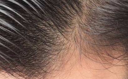 2023年棗莊去眼袋醫(yī)院排行榜最新整理，公立醫(yī)院與私立醫(yī)院綜合評(píng)價(jià)對(duì)比!