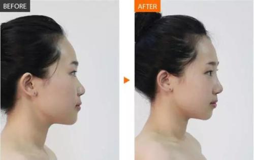 2023年成都做鼻部整形手術(shù)的專家名單公布，了解最可靠的整形醫(yī)生！