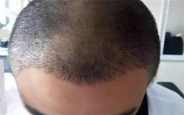 2023年泰州整形醫(yī)院最新排名發(fā)布！公立私立醫(yī)院對(duì)比，看看哪個(gè)更值得選擇！