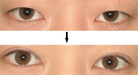 2023年天津口腔醫(yī)院正畸療效排名搶眼，悄然成為人們熱議話題的前5家推薦！