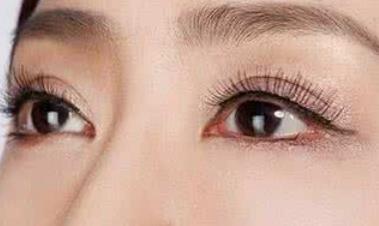 西安伊婉玻尿酸填充淚溝醫(yī)生