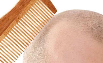 2023年南京口腔矯正醫(yī)院排行榜公布！這三家醫(yī)院上榜了！