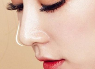 無錫上眼瞼填充玻尿酸醫(yī)生