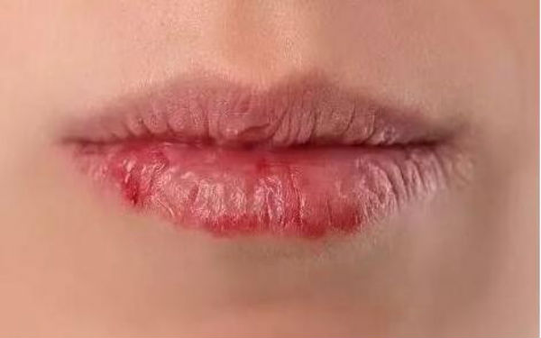 石家莊做眼袋手術(shù)醫(yī)生