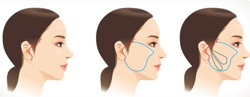 2023年淮安整形醫(yī)院近五年中綜合回顧，美麗殿堂華麗揭幕，蘇王獨(dú)領(lǐng)前列！