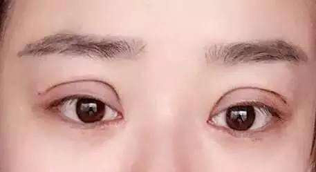 廣州乳房下垂上提醫(yī)生