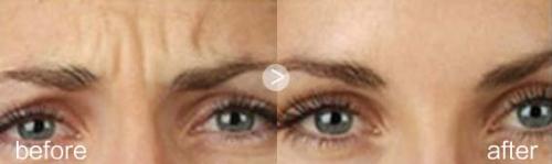 2023年宿遷市百?gòu)?qiáng)面部整形醫(yī)院—全新整形醫(yī)院排行榜