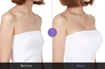 上海五家豐胸整形醫(yī)院最新排行榜來襲！伊萊美、華美霸占前三，趕快存起來，供您參考！