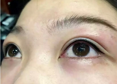 上海隆鼻手術(shù)最佳選擇揭曉！薇琳對(duì)玫瑰，網(wǎng)友大調(diào)查揭曉入圍醫(yī)院名單！