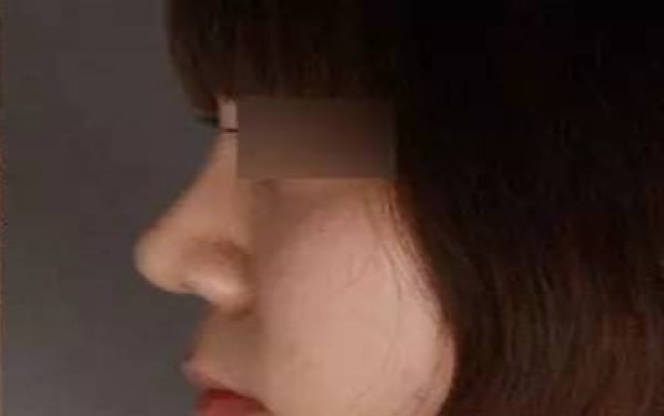 2023濟(jì)寧暢銷整形醫(yī)院匯總：抽脂技術(shù)亮眼，讓你輕松擁有完美身材！