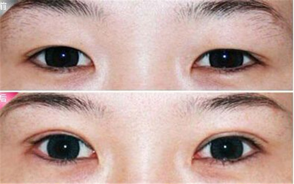 東莞最佳口腔診所盤點(diǎn)：這些醫(yī)院時(shí)刻守衛(wèi)您的口腔健康！