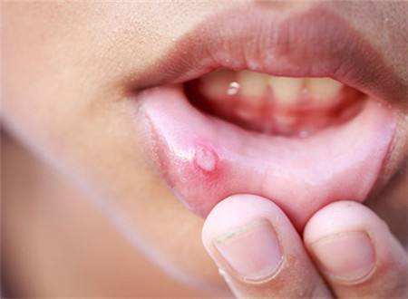 杭州注射膠原蛋白隆鼻醫(yī)生