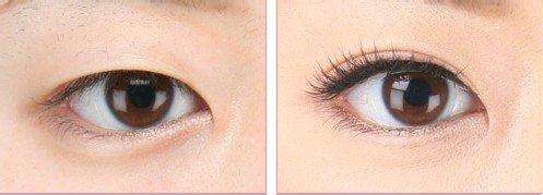 上海專家推薦：首爾麗格、虹橋醫(yī)院為你的祛疤首選！