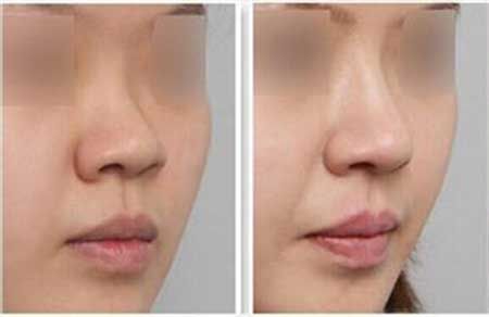 “莊洪興與蘇法仁：國(guó)內(nèi)頂尖專家的最新發(fā)現(xiàn)讓人期待！”