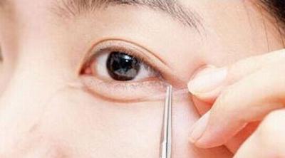 7月五家重慶有名氣的整形醫(yī)院優(yōu)惠價(jià)大比拼！整容專家曬出匯總單，誰是冠軍？