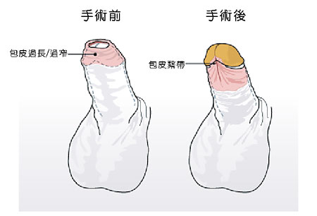 2023長沙頭發(fā)再生專家整理：頂級植發(fā)醫(yī)生推薦奉上