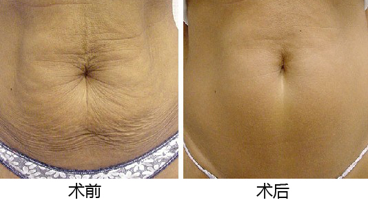 義烏整形醫(yī)院優(yōu)選TOP5，專業(yè)權(quán)威推薦，如何做出準(zhǔn)確選擇？深入了解為上策