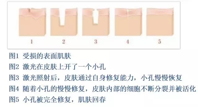 樂(lè)山整形美容院推薦！想在樂(lè)山做整形的話，這些建議不容錯(cuò)過(guò)！