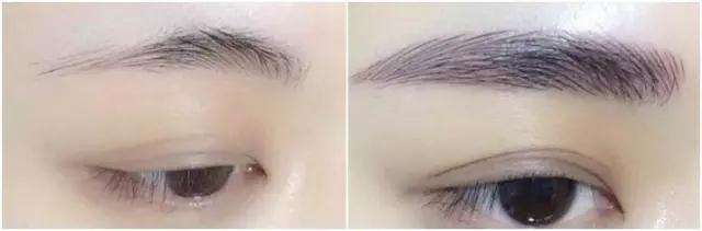 東莞抽脂瘦臉醫(yī)院TOP6，點評一網(wǎng)打盡！