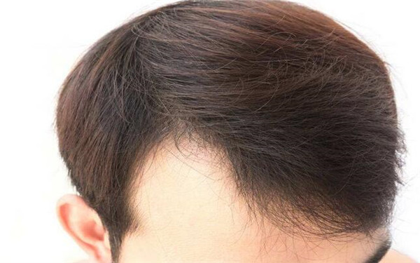 2023長(zhǎng)沙祛斑?？漆t(yī)院排名前八！雅美第二_愛(ài)思特預(yù)約攻略揭秘