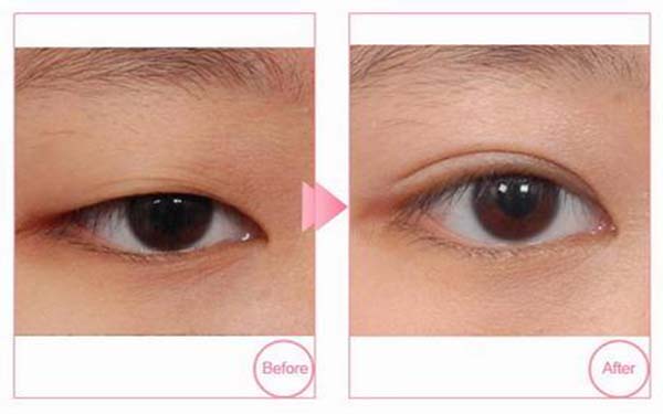 上海五家優(yōu)質(zhì)祛斑美容醫(yī)院盤點(diǎn)