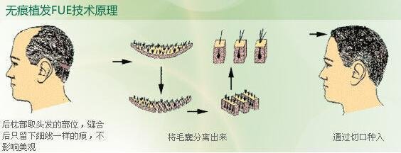 東莞最佳口腔診所盤點：解決牙齒健康問題的最佳選擇！