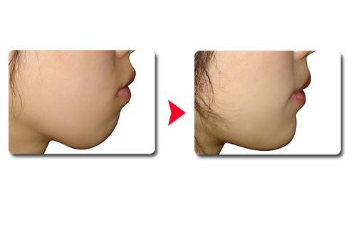 東方美萊塢推出最新臨雙眼皮整形醫(yī)院清單，眾評盛贊其技術(shù)實力！