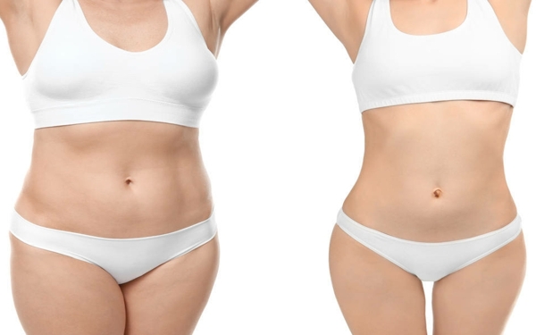 2023鄭州三甲公立整形醫(yī)院推薦：安心暢享完美整容之旅