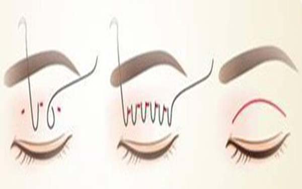 臨沂市七家頂級整形美容醫(yī)院推薦，祛斑護膚新方法揭秘