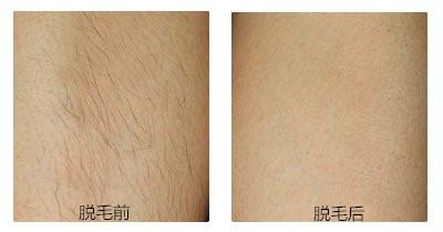 專業(yè)推薦！新疆頂級眼袋整形醫(yī)生綜合評價(jià)排行盤點(diǎn)