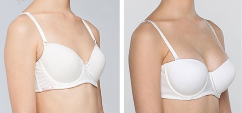 溫州仿生鼻綜合醫(yī)生