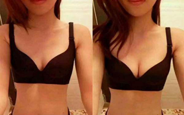 天津膠原蛋白填充臉頰醫(yī)生