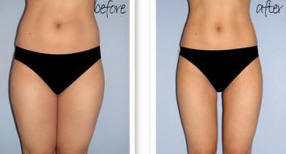 揚(yáng)州上眼瞼注射填充醫(yī)生