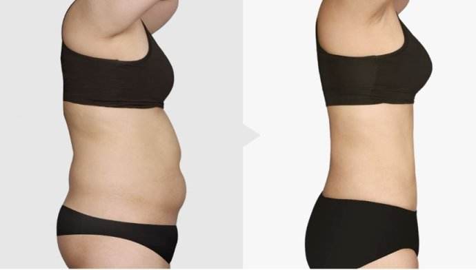 南京激光祛斑專科醫(yī)院一覽：綜合實力強大，安心選擇！