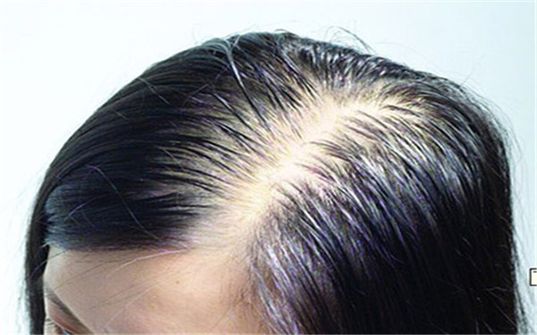 蘭州頂級整形專家推薦：激光祛斑三甲醫(yī)院排行榜！專業(yè)機構(gòu)值得信賴！