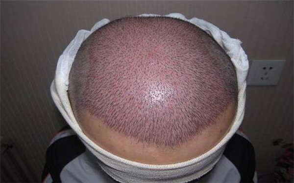 合肥整形醫(yī)院大比拼，公立與私立醫(yī)美斗法，哪家成為你的首選